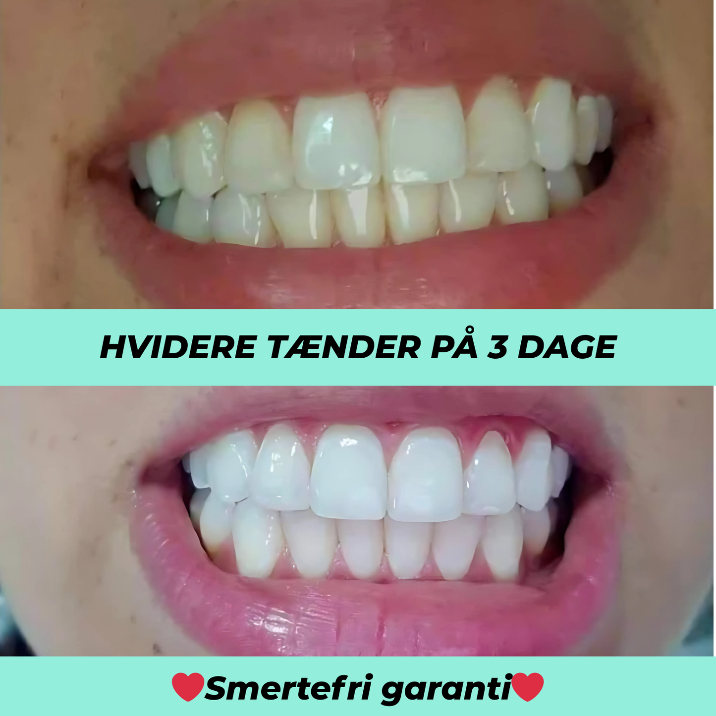 SmileBright™ | Professionelle resultater uden dyre tandlægebesøg
