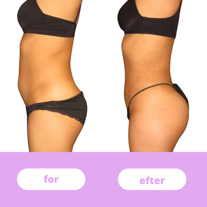 GluteMaster™ – Booty Trainer til fastere og stærkere balder