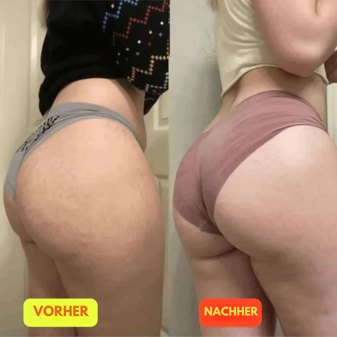 GlutePro™ Max – Fitnessband für einen straffen und starken Po